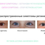Ретинобластома