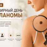 Всемирный день борьбы с меланомой